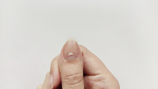 Da li bele linije na noktima nastaju kao rezultat nedostatka vitamina?