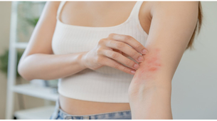 Obratite pažnju: Prvi simptomi nedostatka cinka mogu da se uoče na koži