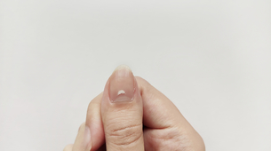 Da li bele linije na noktima nastaju kao rezultat nedostatka vitamina?